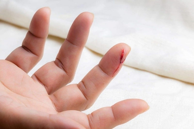 Giải mã giấc mơ thấy mơ bị chảy máu: Điềm báo gì?