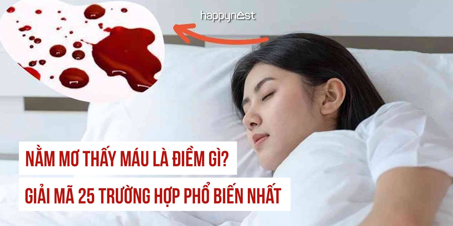 Mơ thấy chảy máu mũi liên quan đến sức khỏe: Cảnh báo cần lưu ý