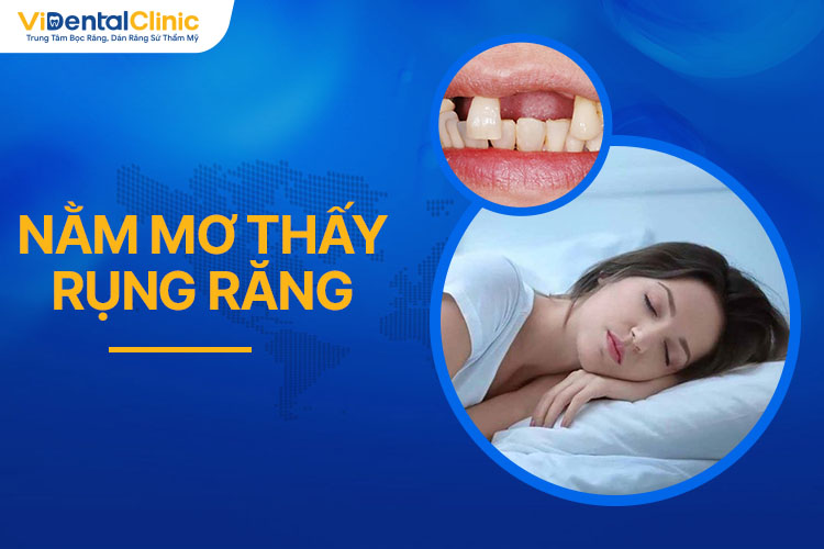 Mơ thấy rụng răng: Ý nghĩa tâm linh và điềm báo tương lai