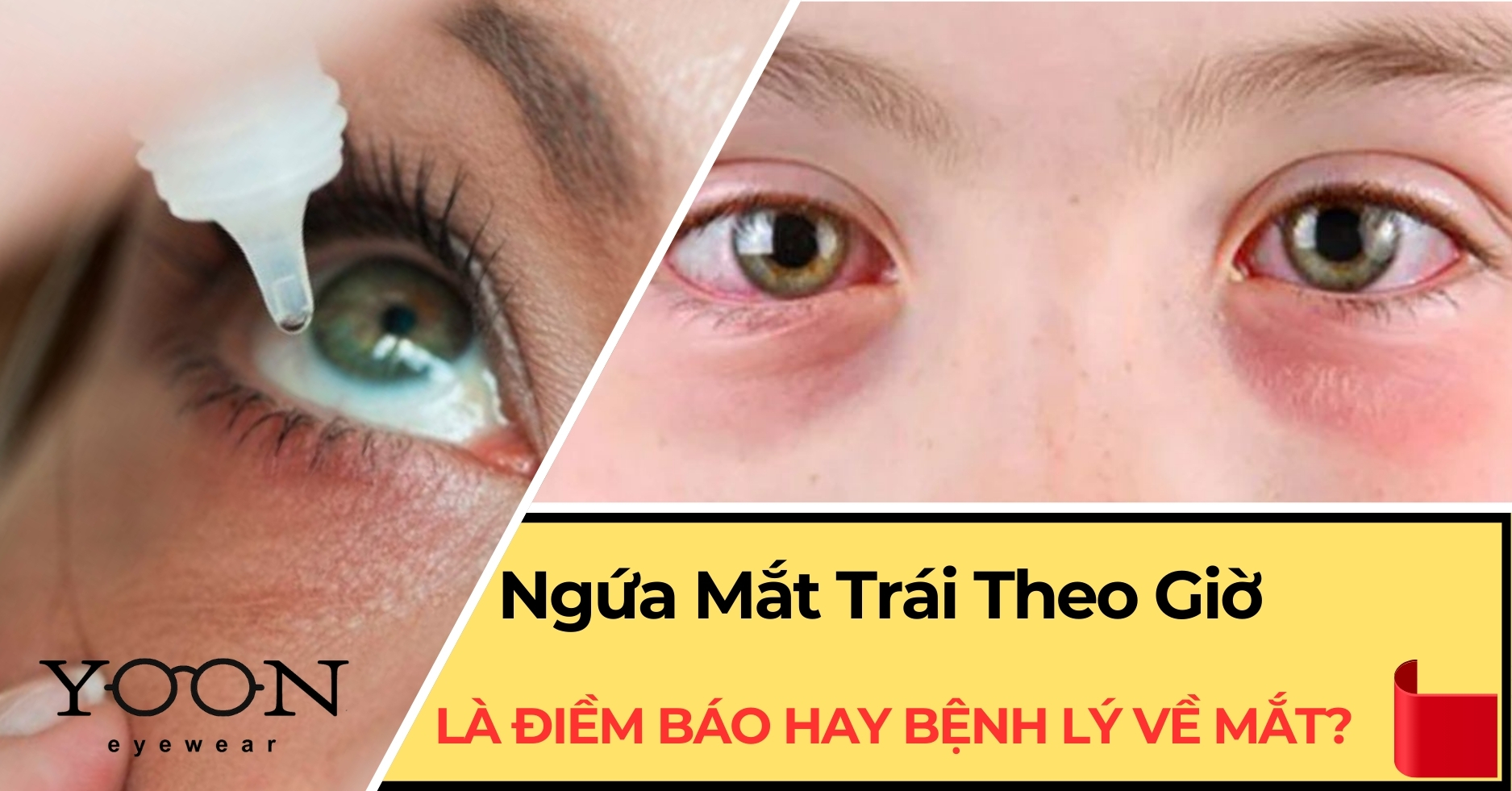 Ngứa mắt trái, mắt phải: Ý nghĩa khác biệt theo giới tính và thời gian